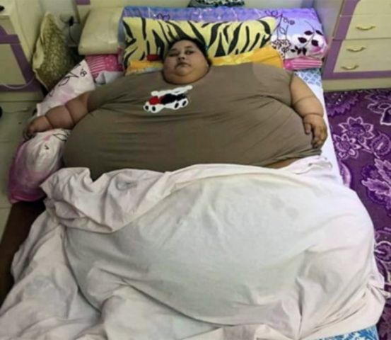 मिलिए दुनिया की सबसे मोटी महिला से, 500 किलो है वजन