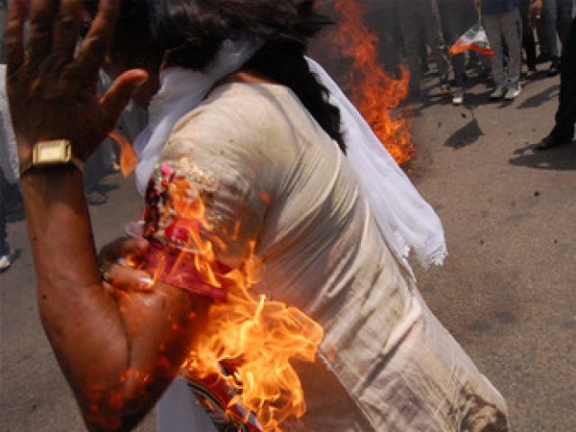 मोदी को जलाने आए कांग्रेसी कार्यकर्ता के हाथ जले