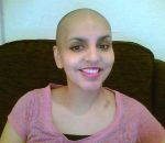 कैंसर पीड़ित महिला, मरने से पहले भी लोगो को हंसा गई