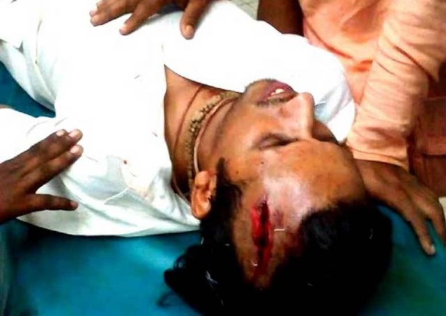 बांग्लादेश में इस्काॅन मंदिर में धमाका, घायल अस्पताल में भर्ती