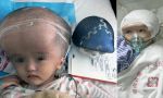 अद्भुत! चीन में बच्ची की खोपड़ी को थ्री-डी प्रिंटिंग के जरिए तैयार किया गया