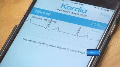 चिकित्सा के क्षेत्र में क्रन्तिकारी परिवर्तन मोबाइल एप्प के माध्यम से ECG रिपोर्ट