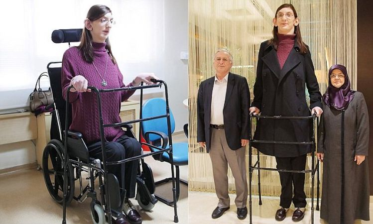 ये है दुनिया की कम उम्र वाली लेकिन सबसे लंबी लड़की, जो है अजीब बीमारी से ग्रस्त
