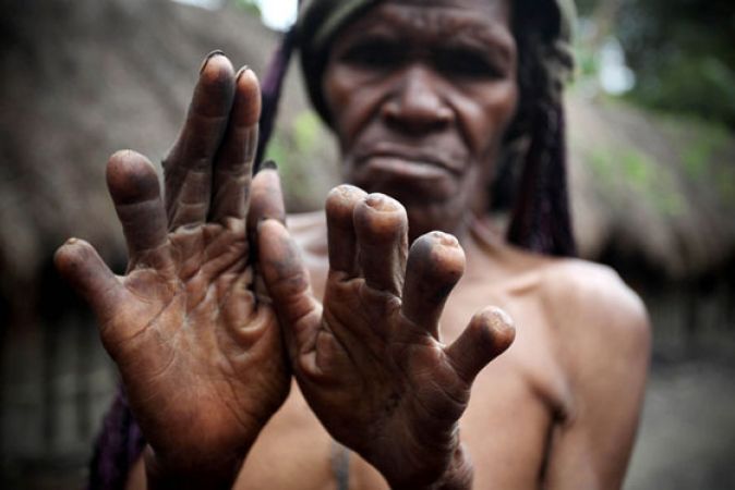 आत्मा की शांति के लिए इस परंपरा के लोग काट देते हैं महिलाओं के हाथ की उंगलियां
