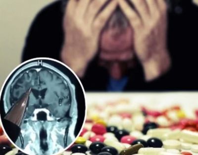 This man, who had been taking epilepsy medicines for 30 years, was shocked to know...