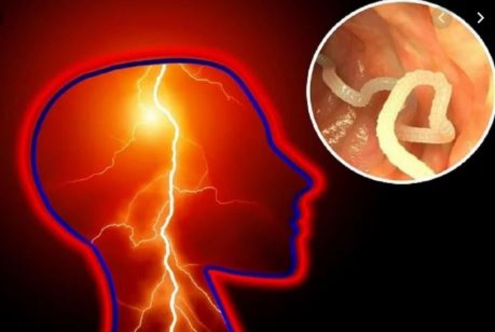 Doctors found more than 700 tapeworms in a man's body