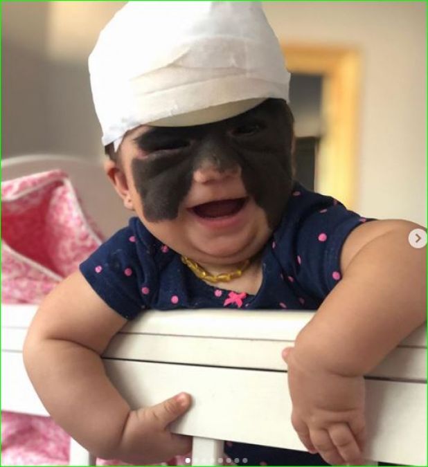 This girl has a 'Batman mask' like birth mark, doctors reveal shocking