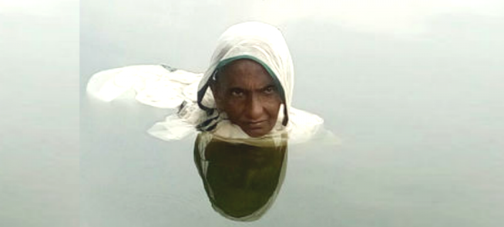 इस बीमारी के कारण करीब 20 साल से पानी में रह रही है ये महिला