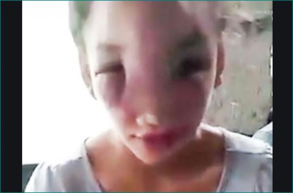Girl left with huge facial swelling after squeezing a pimple on her nose in Philippines