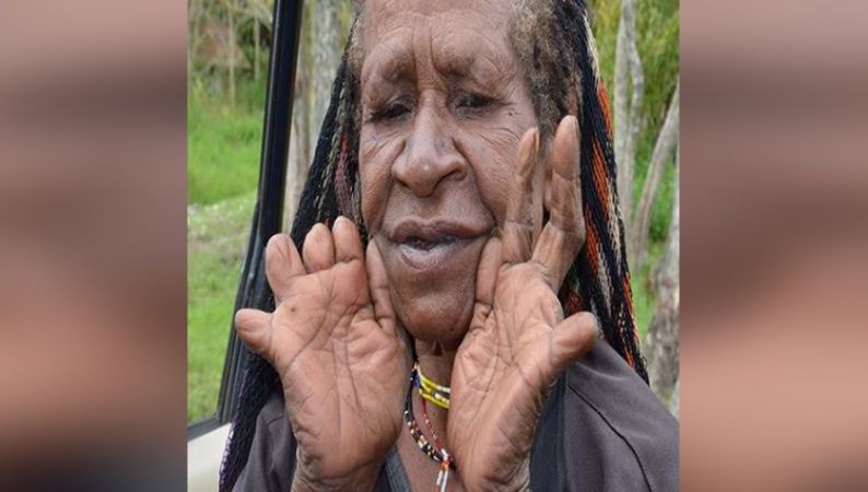 क्रूर परंपरा : मुखिया की मौत पर काट दी जाती है महिलाओं की उंगलियां