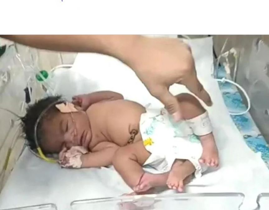 4-legged baby girl born in Gwalior, crowd of onlookers gathered