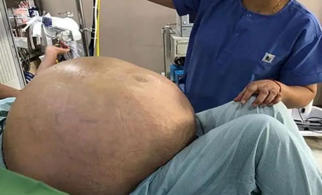 Suddenly stomach of elderly woman started growing, doctor made dangerous disclosure