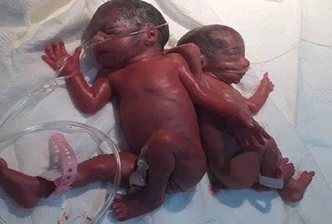 महिला ने नार्मल डिलीवरी में एक साथ दिया 7 बच्चों को जन्म