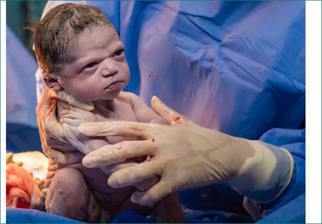 After birth, doctors were trying to make the girl cry but she became angry and ...