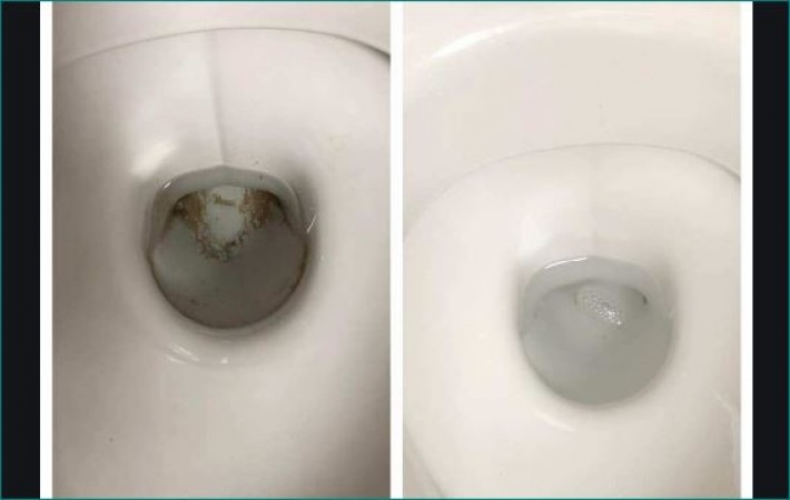 Man's hand stuck in toilet while trying to take out car keys