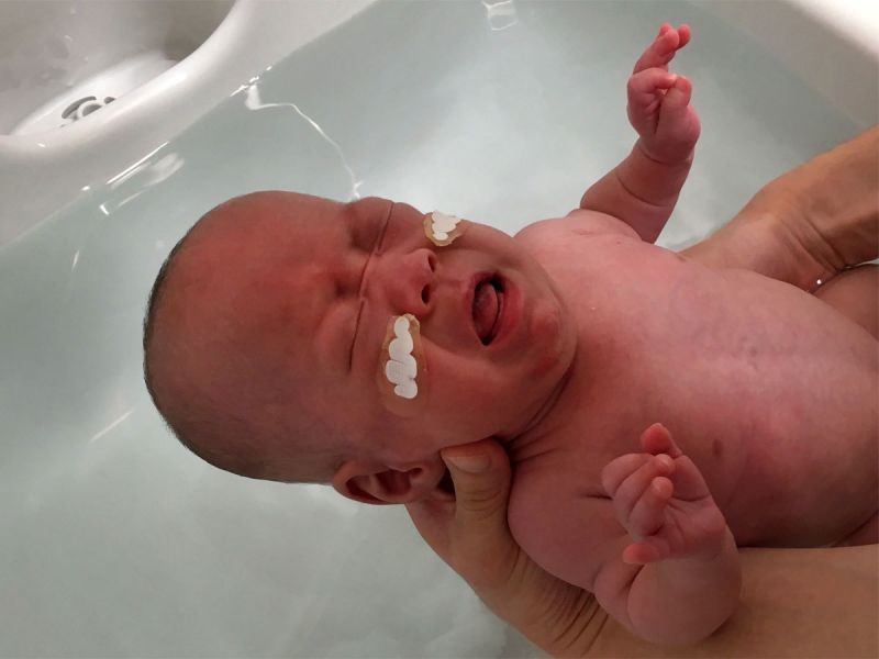 ये है दुनिया का सबसे छोटा बच्चा, जन्म के समय प्याज जितना वजन था