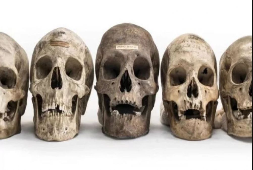 Here are human skulls sold online, Know other special facts
