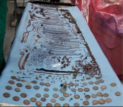 1.5 kg jewellery and coins removed from woman's stomach in Bengal