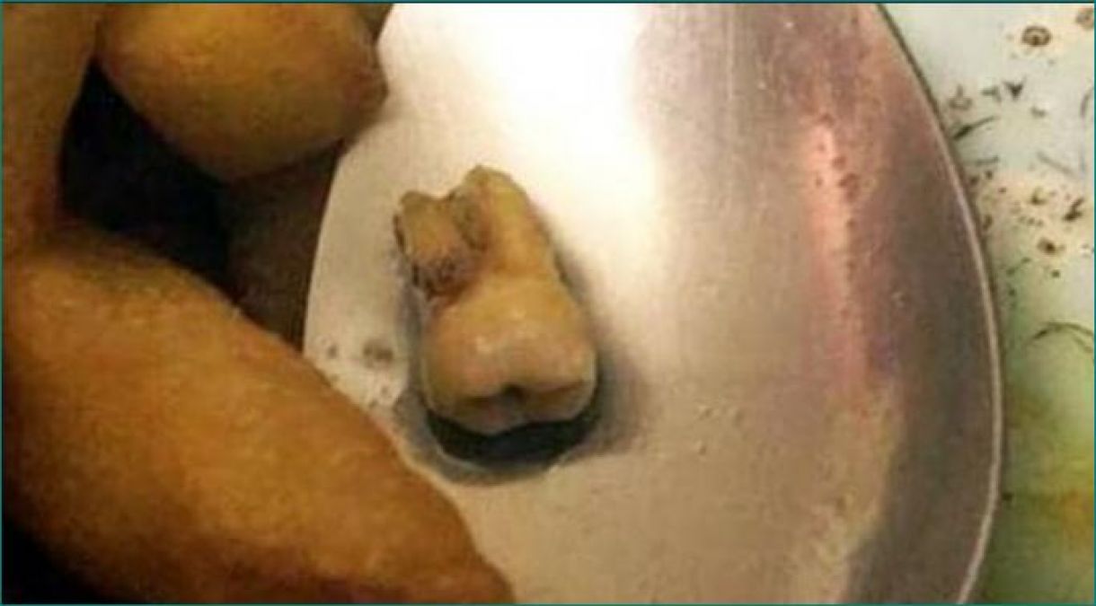 Human tooth found in food ordered from restaurant, Know complete matter