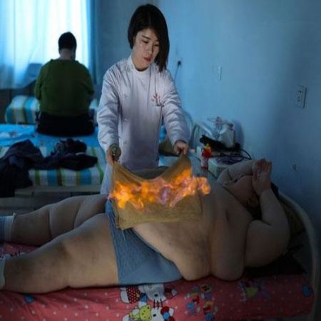 चीन में शरीर पर आग लगाकर किया जाता है बॉडी का फैट कम