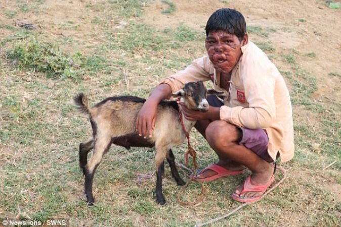 बिहार के इस लड़के को गांव वाले कहते हैं Ghost Boy