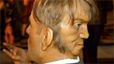 ये है दुनिया का पहला दो चेहरे वाला इंसान, सच्चाई जानकर रूह काँप जाएगी