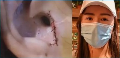 Woman returns home after undergoing nose surgery and found this body part missing