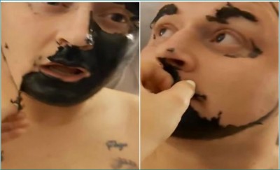 VIDEO: Young man used black charcoal to remove dark spots but experienced unbearable pain