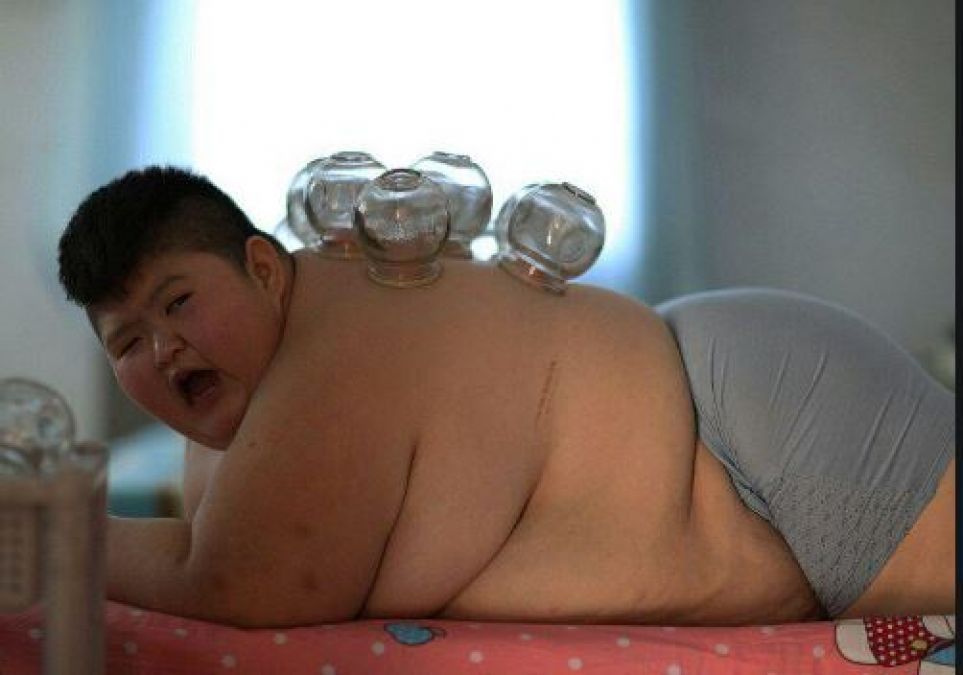 मोटापा कम करने के लिए नहीं करना होगा वर्कआउट, चीन में अपना रहे ये अजीब तरीका