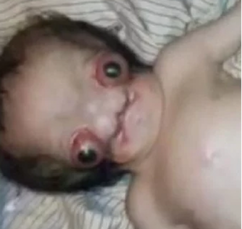 यहाँ हुआ एक ऐसे बच्चे का जन्म जिसे लोगों ने कहा एलियन