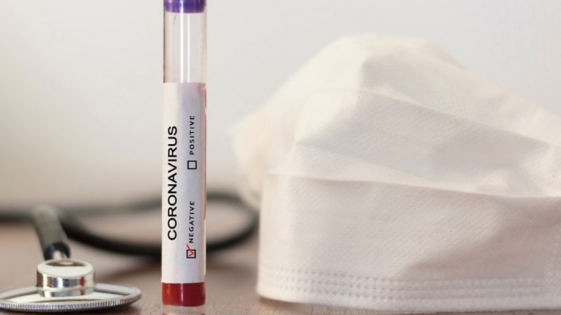 WHO's big statement, PCR-based tests probably most accurate for coronavirus
