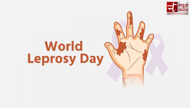Know why World Leprosy Eradication Day is celebrated