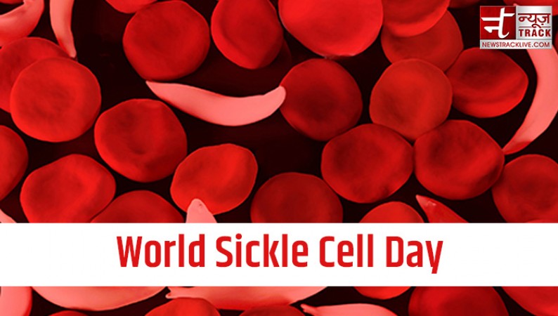 The Reason Why World Sickle Cell Awareness Day is celebrated
