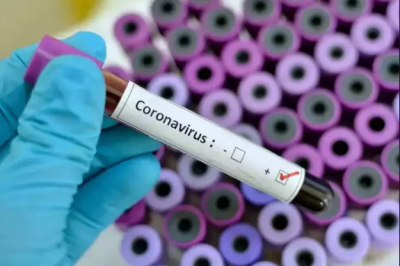 Corona breaks in Australia's lab, drug testing started on humans
