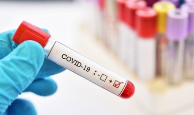 U.S. approves new coronavirus antigen test with fast results