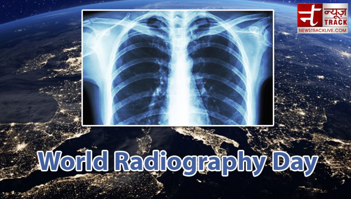 World Radiography Day is celebrated on 8th Nov, Know why?