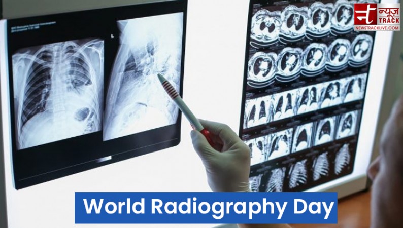 Know why World Radiography Day is celebrated