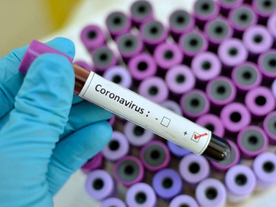 First case of South African coronavirus strain registered in Italy